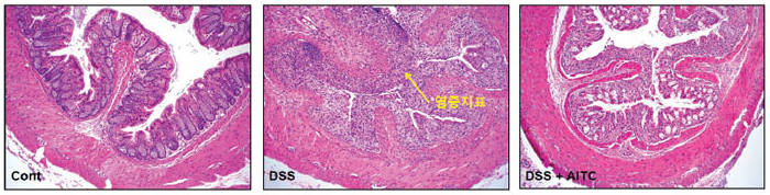 염증성 장 질환에서 AITC의 조직병리학적인 보호효과